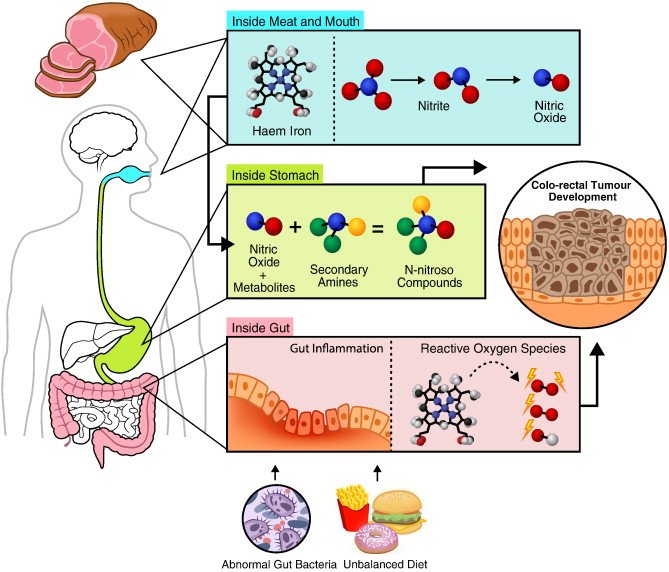 How Meat Causes Tumors In The Colon